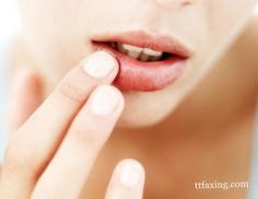 冬季嘴唇干裂起皮怎么办 预防嘴唇干裂起皮的方法